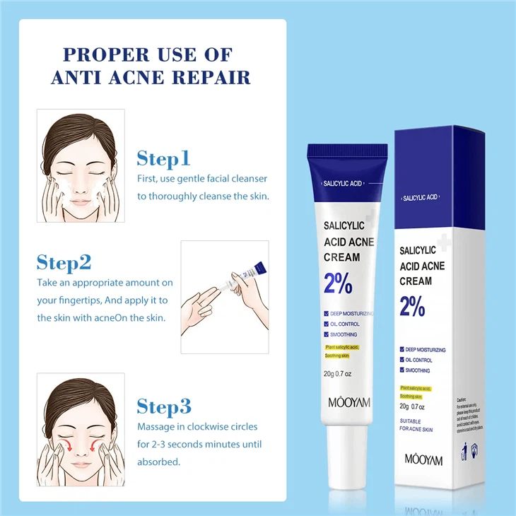 2% Salicylic Acid Acne Cream